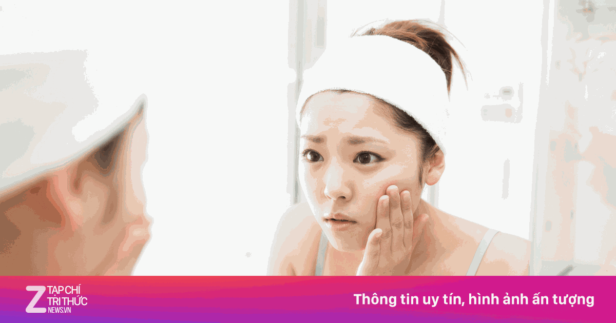 Nguyên nhân bị mụn và cách xử lý tại nhà