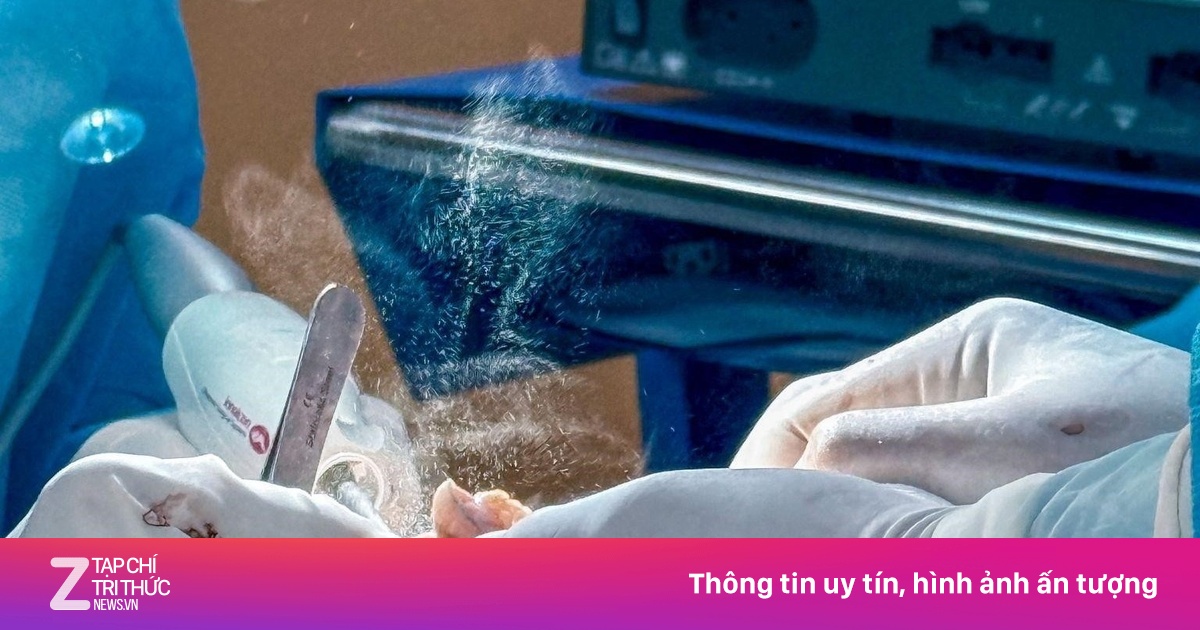 Ngực tái sa trễ sau phẫu thuật thẩm mỹ