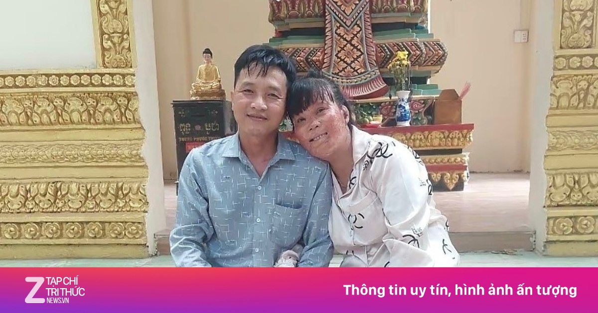 Người phụ nữ bỏng 78% cơ thể vì cứu con riêng bạn trai, tìm thấy hạnh phúc sau 19 năm