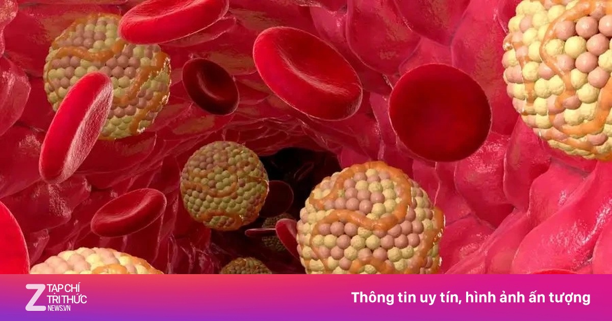 Căn bệnh âm thầm từ bữa ăn, nhiều người Việt đang mắc