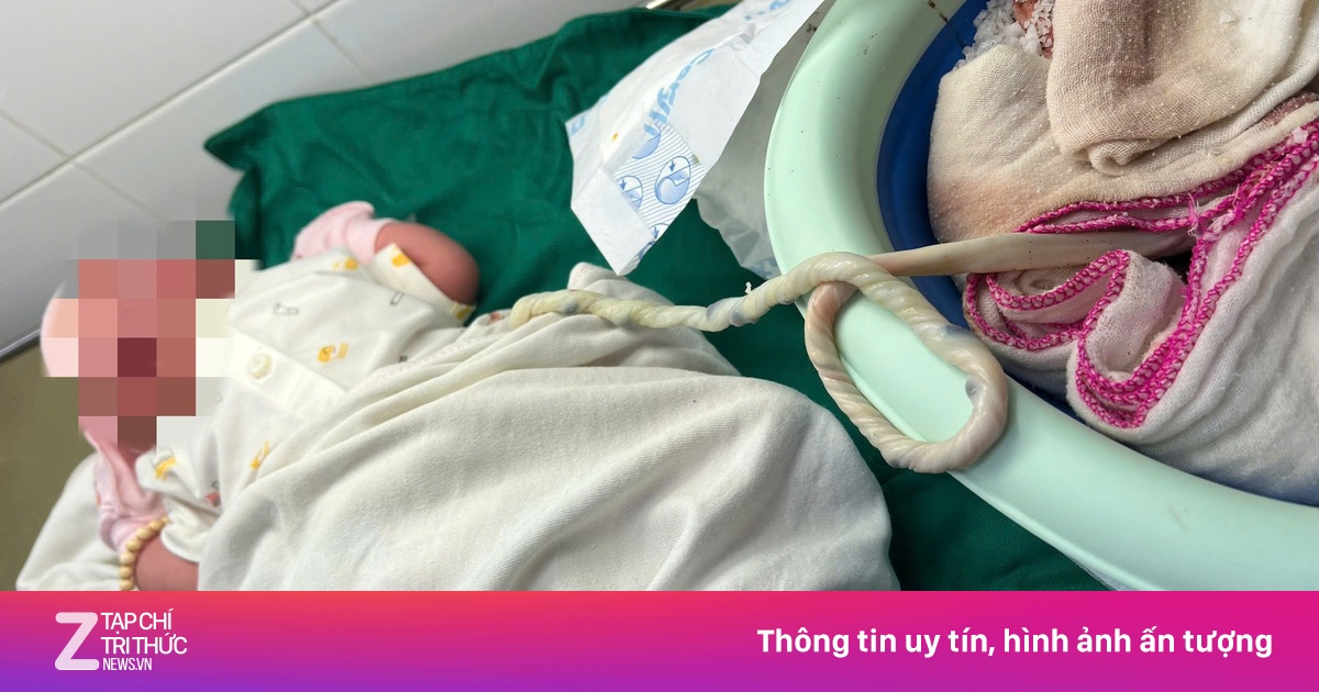 Con gặp nguy vì mẹ khăng khăng sinh con 'thuận tự nhiên' tại nhà