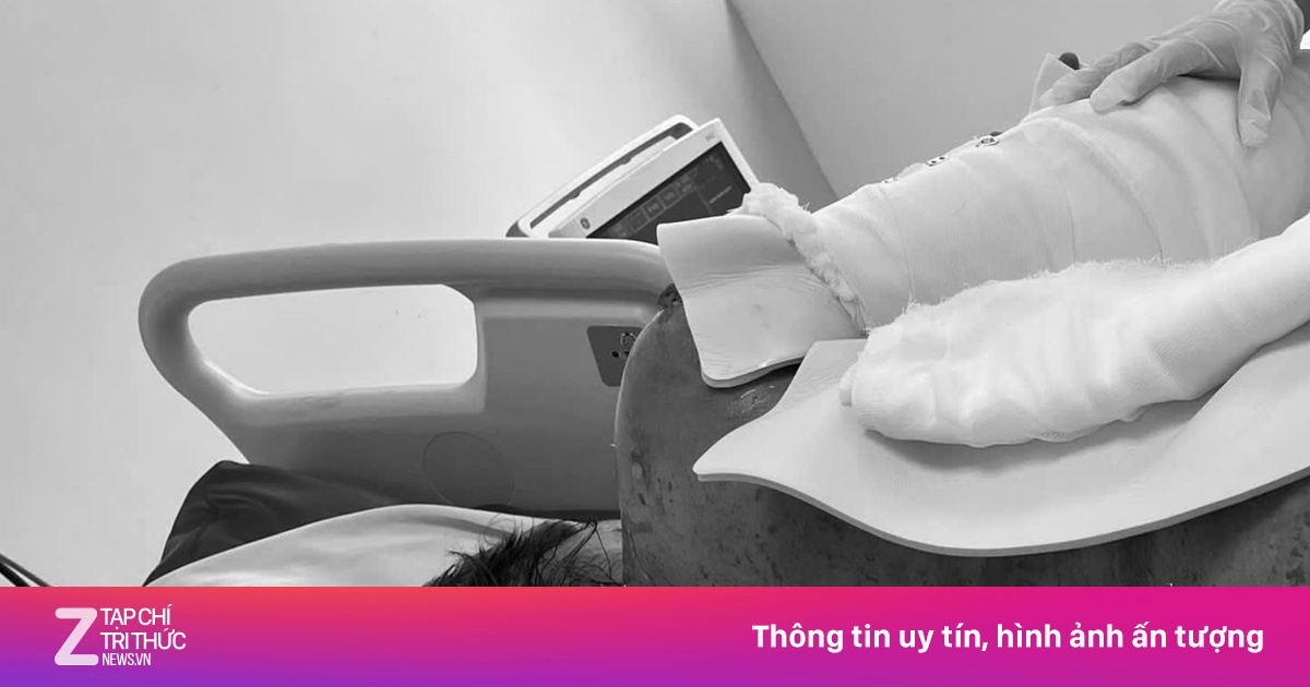 Người phụ nữ bong tróc da 92% do hội chứng hiếm gặp