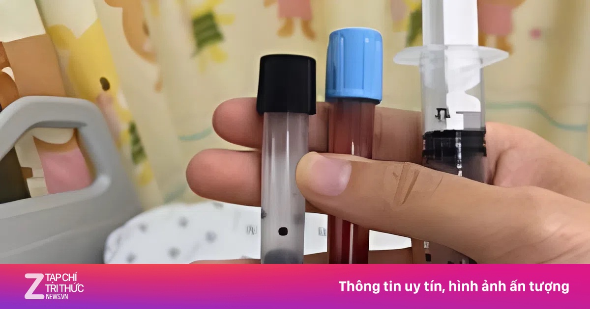 Máu bé gái chuyển đen do ngộ độc methemoglobin