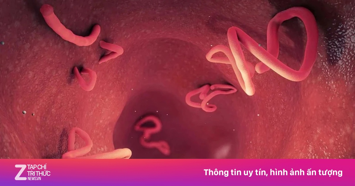 Kẻ âm thầm tấn công não, gây áp xe gan mà nhiều người lãng quên