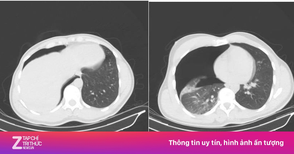 Du khách Nga gặp tai nạn nghiêm trọng, bác sĩ TP.HCM xuyên đêm cứu sống