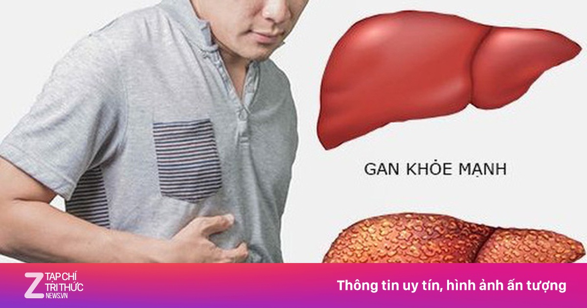 Yếu tố làm tăng nguy cơ mắc ung thư gan