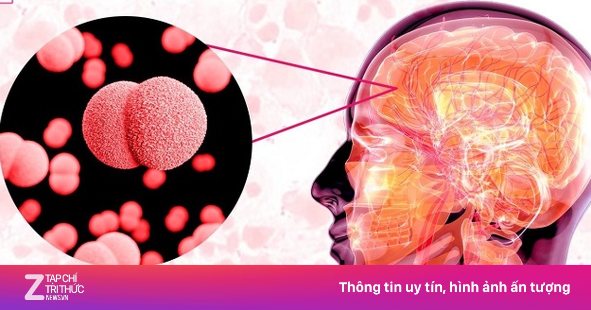 Viêm não mô cầu: Bệnh nguy hiểm lây qua đường hô hấp và dấu hiệu nhận biết đặc trưng