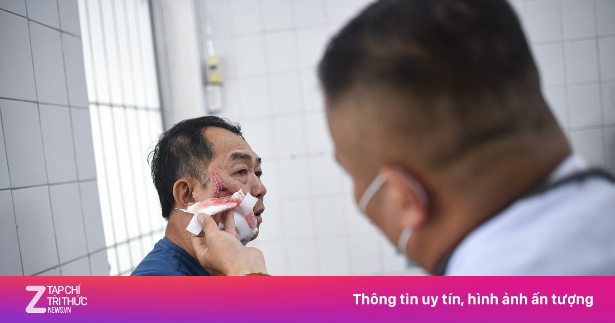 TP.HCM cảnh báo bệnh dại gia tăng, 3 ca tử vong chỉ trong 4 tháng đầu năm