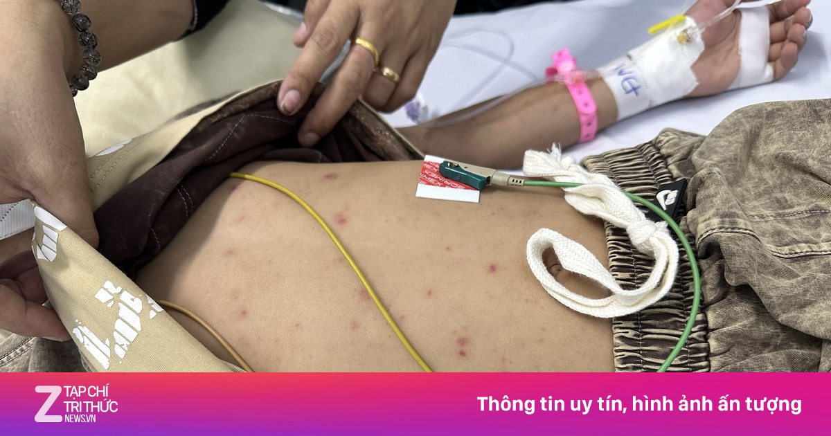 Bé trai 7 tuổi ở TP.HCM nguy kịch chỉ sau hai ngày sốt