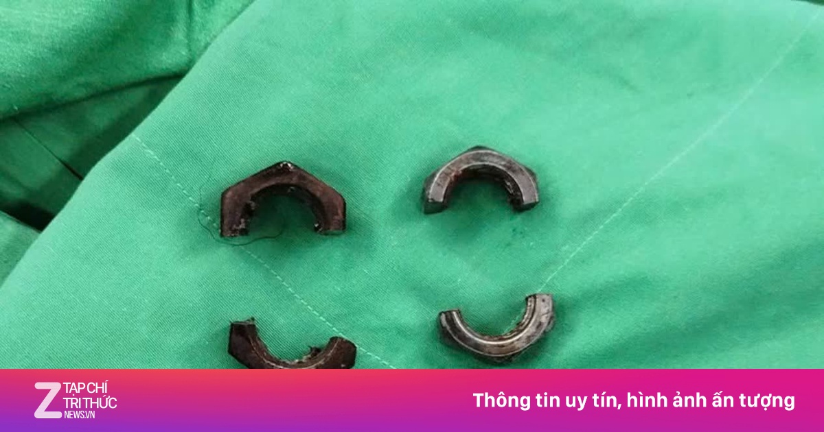 'Cậu nhỏ' biến dạng vì đai ốc siết, người đàn ông 38 tuổi đi cấp cứu