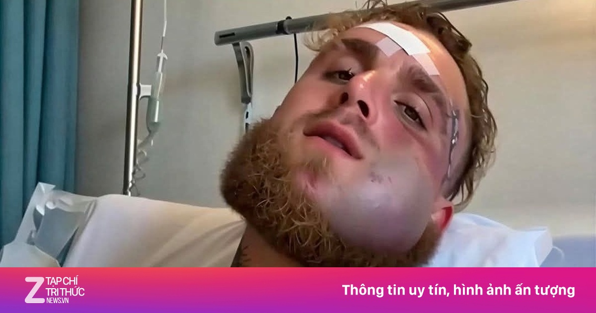 Mặt Jake Paul biến dạng
