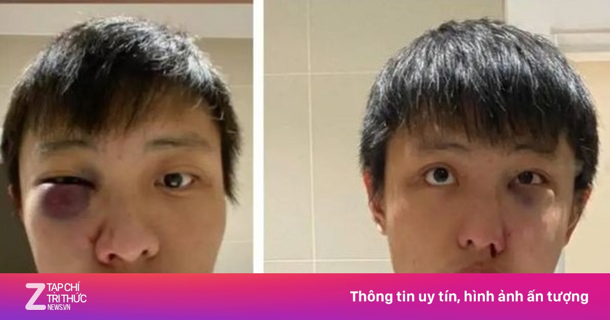 zingnews.vn