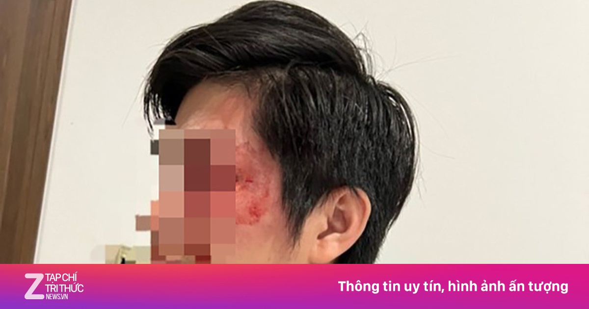 zingnews.vn