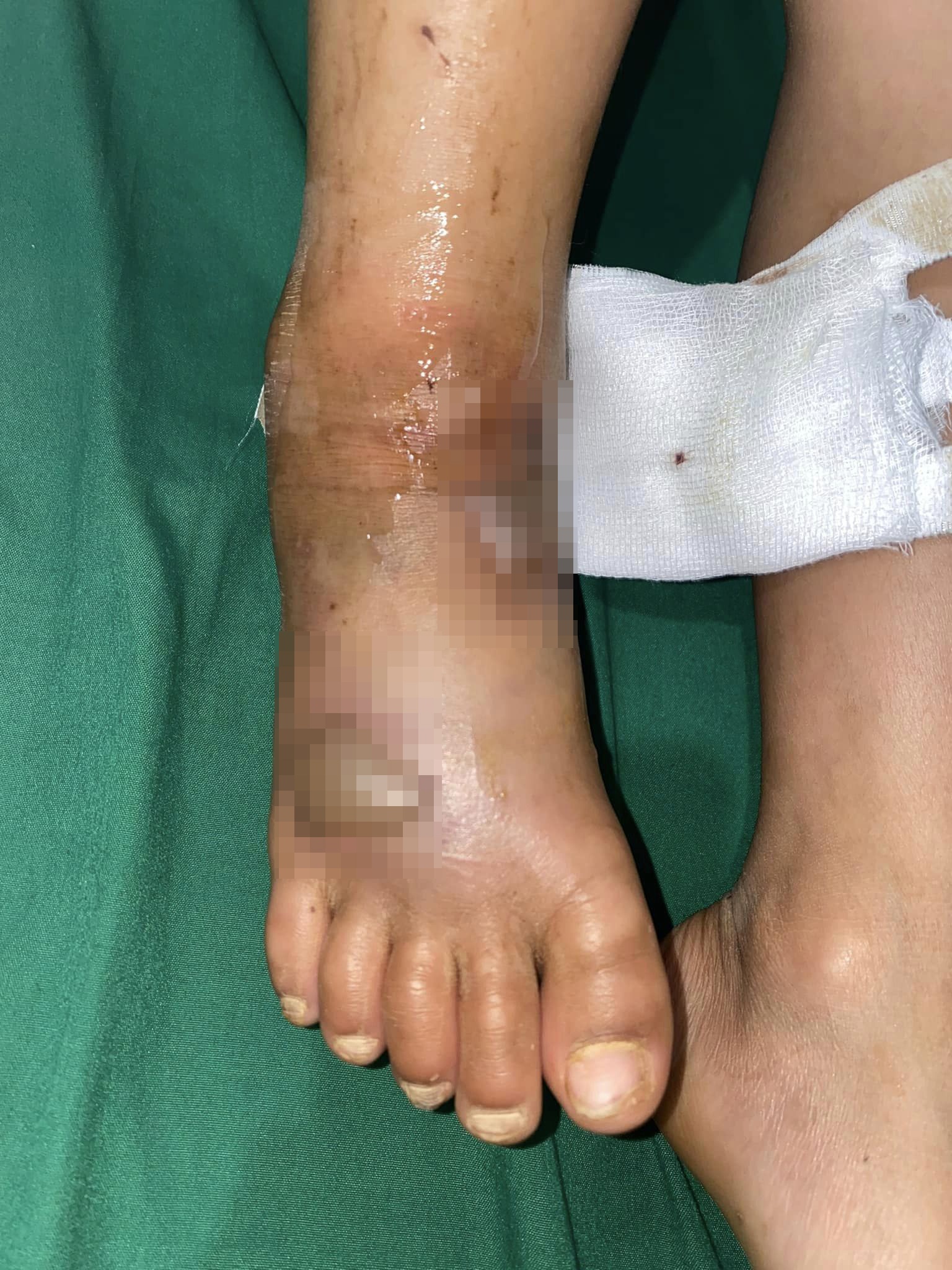 ran doc can anh 1