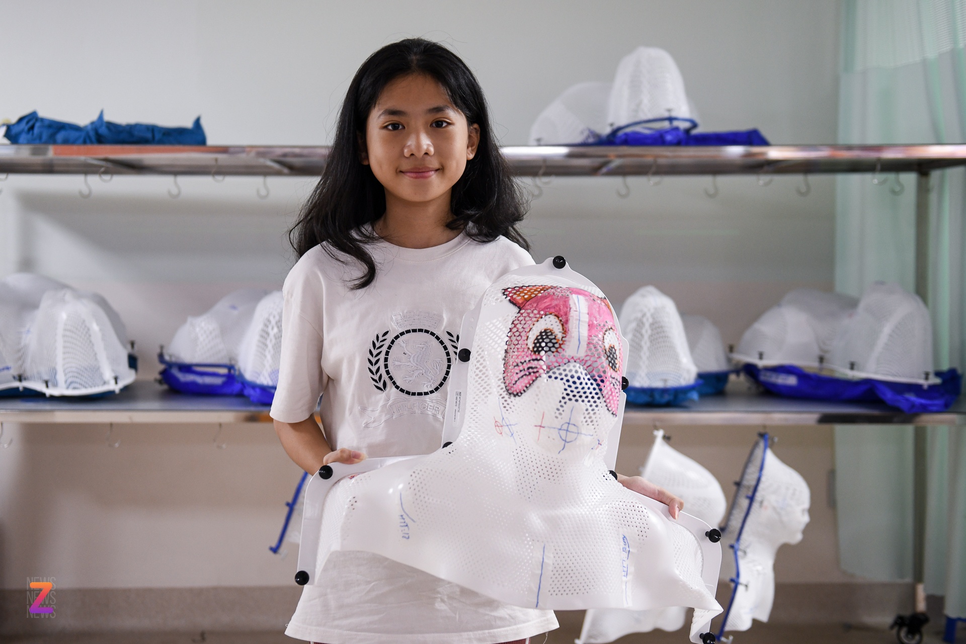 ung thu anh 8