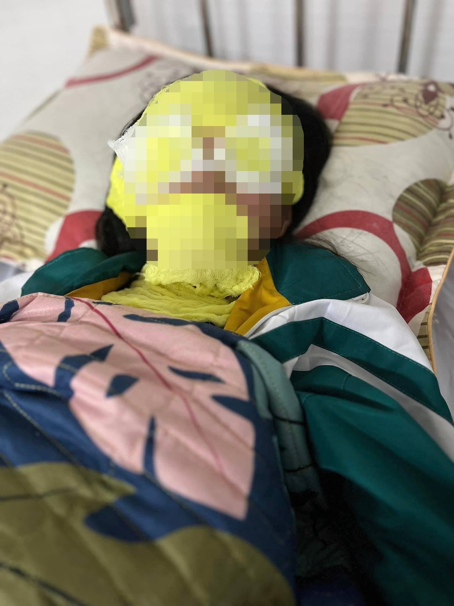 bi bong anh 1