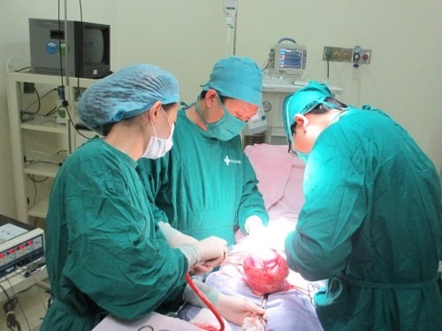 Một ca phẫu thuật u xơ tử cung khổng lồ.