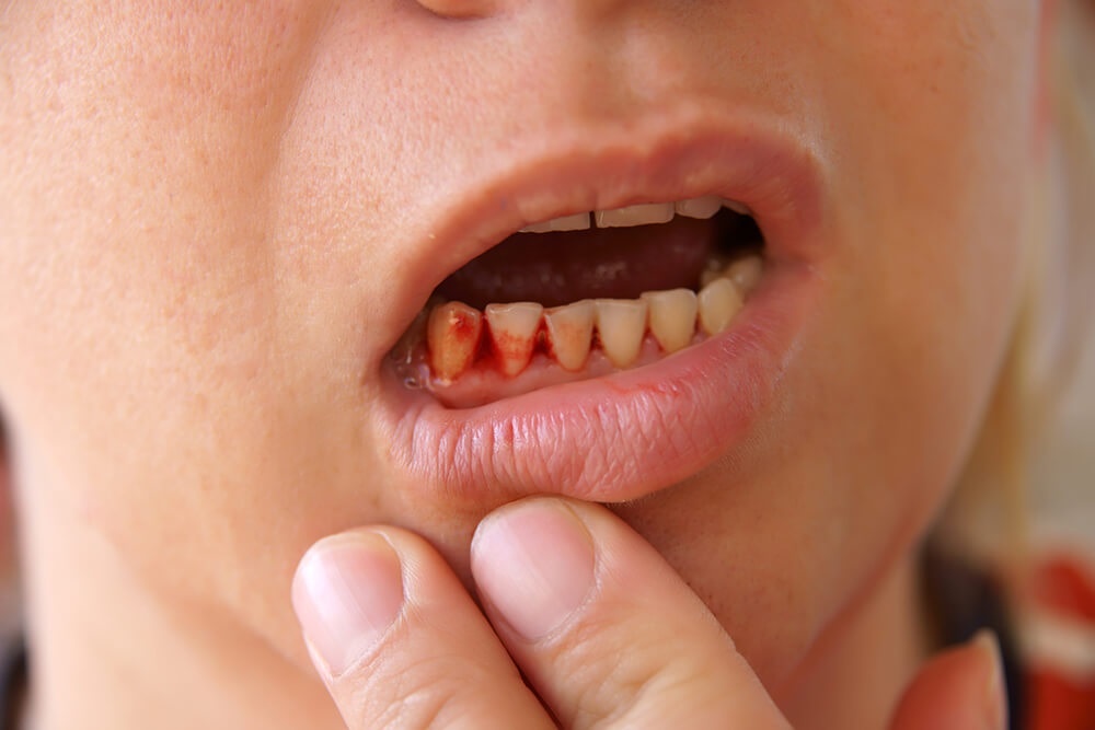 Bất thường khi ngủ dậy ảnh 4 Bat thuong khi ngu day anh 4