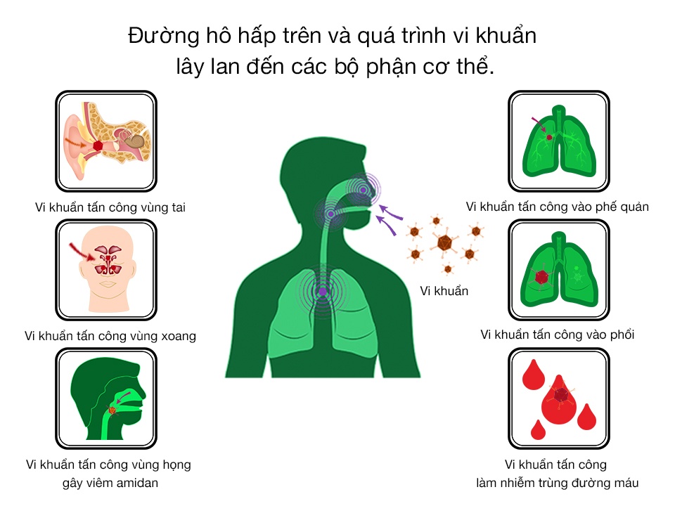 Star Sore Throat anh 1