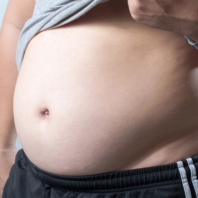 nguyen nhan beo bung anh 2