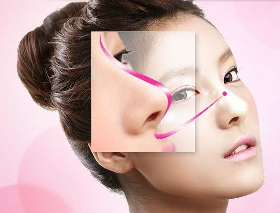 mui S-line an toan anh 1