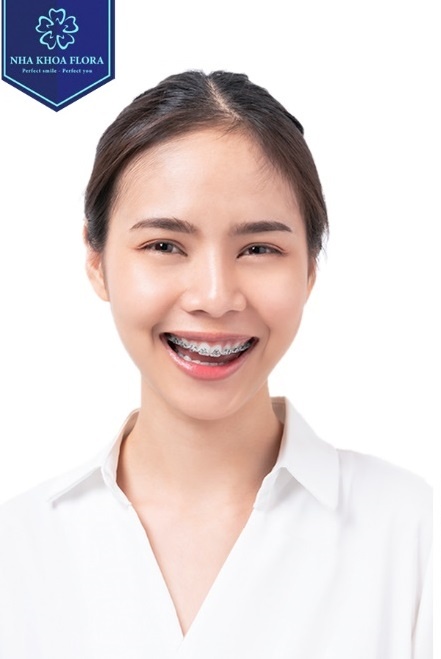 nieng rang trong suot anh 1