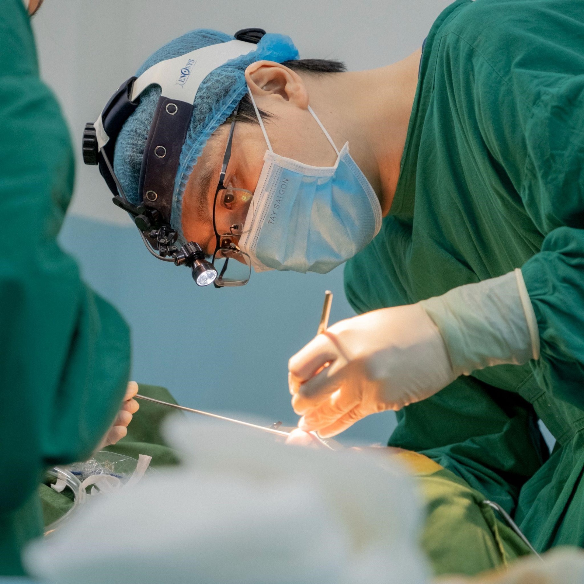 Phau thuat hut mo bung anh 1