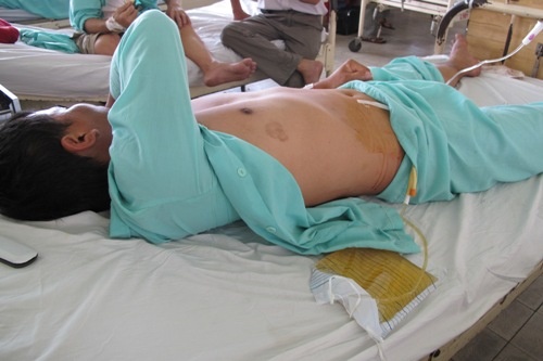 Một nạn nhân bị cắt 