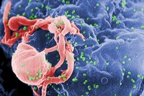 Co gai 18 tuoi kiem soat virus HIV 12 nam khong dung thuoc hinh anh