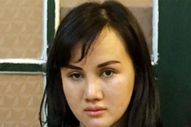 Phau thuat nham tron ban an 15 nam tu hinh anh