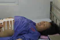 San phu vo oi, thai nhi lot tay ra ngoai hinh anh