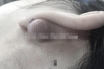 Co gai cat bo seo loi to bang hat lac vi xo khuyen tai hinh anh