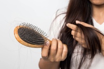 Chưa đến 30 tuổi tóc đã rụng cả nắm