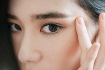 Không biết nên vui hay buồn sau khi cắt mí