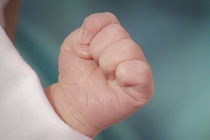 Bé trai 21 tháng tuổi nhập viện với bàn tay đứt lìa bọc trong thùng đá