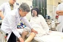 Nguoi phu nu bi tan phe do Lupus ban do hinh anh