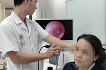 Thu pham khien co gai chay mu tai, dau dau suot nhieu thang hinh anh