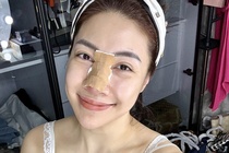 Ca si Pha Le bi bien chung sau nang mui hinh anh
