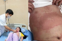 Be gai 8 tuoi nhap vien luc nua dem vi ban nhiem khuan hinh anh