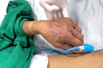 Can benh dang so dang bung phat, tu mon khoai khau cua nguoi Viet hinh anh