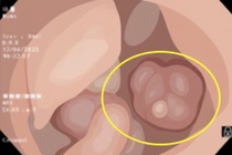 Nguoi dan ong co 3 dau hieu cua benh ung thu nhung khong biet hinh anh