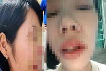 Chỉ đạo khẩn sau vụ phụ huynh xông vào nhà đánh cô giáo