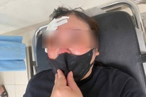 Nu tai xe o Ha Noi 'to' bi nguoi di oto dung dui cui vut vao dau hinh anh