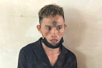 Co gai bi ke dao vao co, cuop dien thoai o cong vien hinh anh