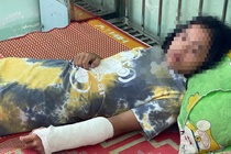 Nữ sinh bị đánh gãy tay trong lớp học