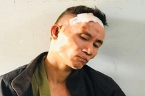 Ga om luu dan co thu o TP.HCM bi khoi to 3 toi danh hinh anh