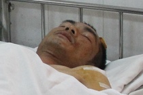 Trung uy cong an bi di roi dien, dam 3 nhat dao hinh anh