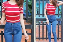 Dang nguoi hinh qua le it bi dai thao duong typ 2 hinh anh