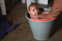 Dau hieu nhan biet nhiem virus Zika hinh anh