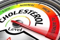 Nguyen nhan pho bien khien cholesterol tang cao hinh anh